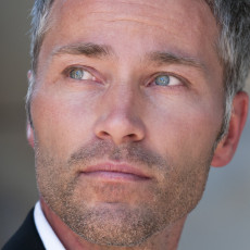 Zufriedener Patient nach dem Eingriff einer Lidstraffung